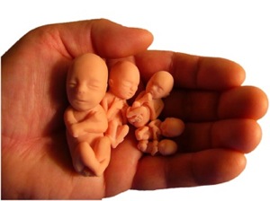 http://www.noisiamolarivoluzione.com/wp-content/uploads/2008/11/abortion1-copy.jpg