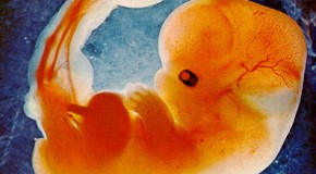 E’ il feto, una persona? 