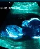 Fermatevi! Le parole di un ex-direttore del Planned Parenthood in Texas